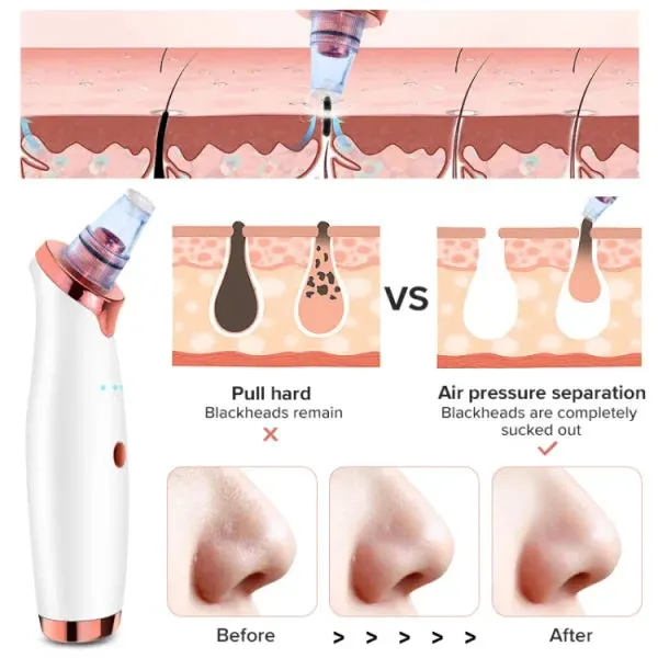 Vacuum Blackhead Remover Pore Cleaner